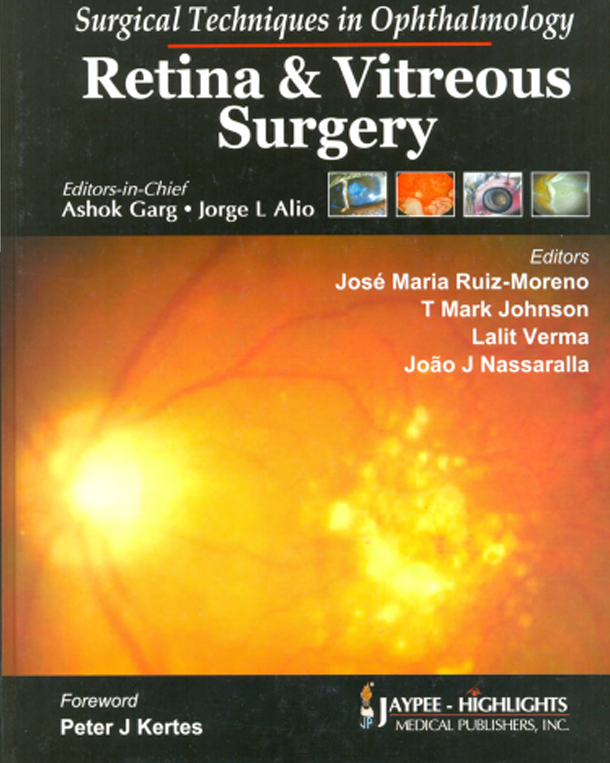 Retina e Vitreous Sugery Retina e Vitreous Sugery