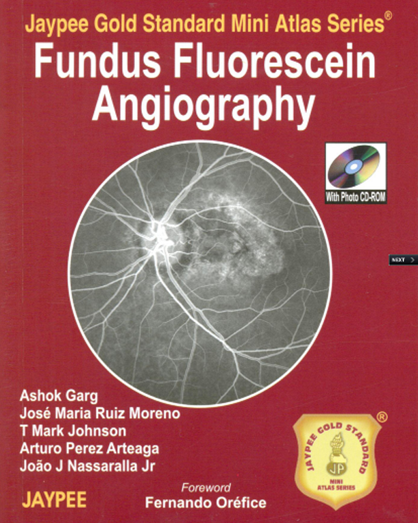 Fundus Fluorescein Angiography Fundus Fluorescein Angiography